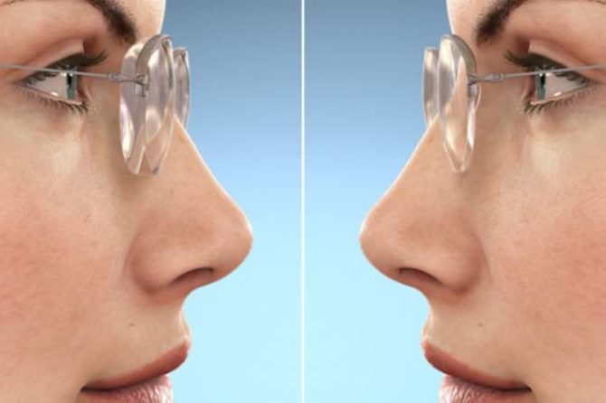 How To Order The Perfect Prescription Lenses For Your Glasses At Ezcontacts Ezontheeyes 