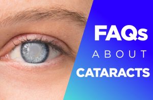 cataracts FAQs