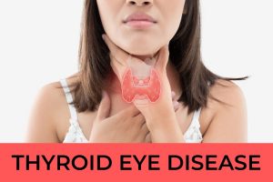 Thyroid eye disease