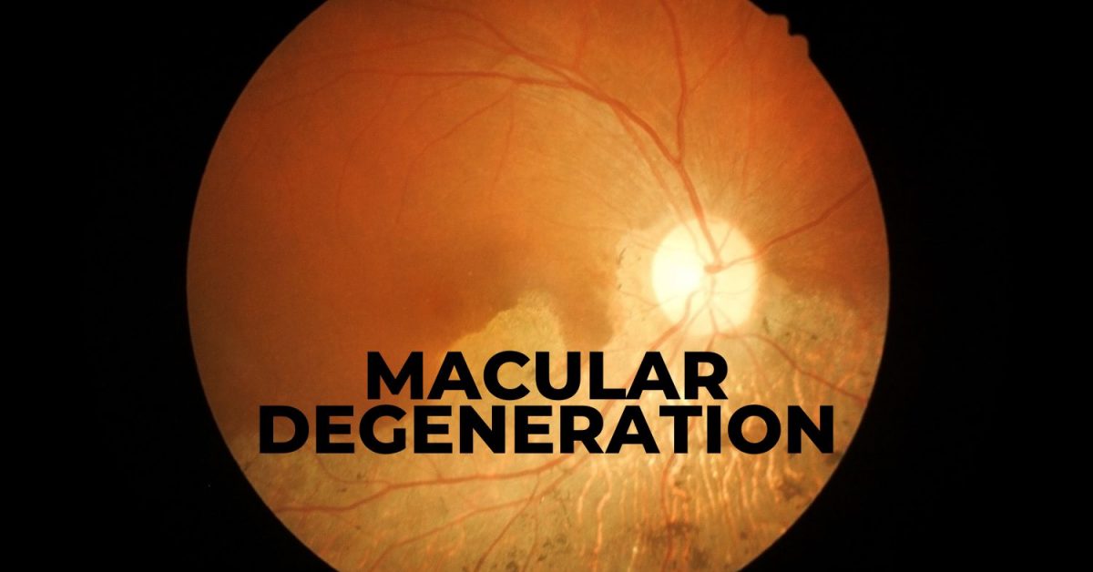 Are You at Risk for Macular Degeneration? - EZOnTheEyes