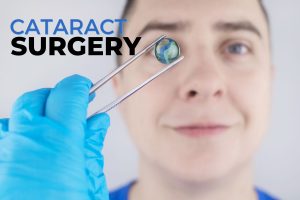 Cataract surgery