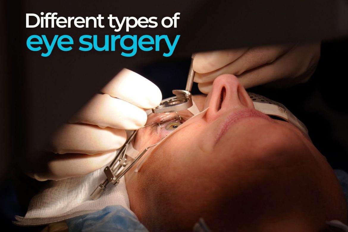 types of eye surgery