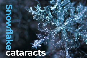 snowflake cataracts