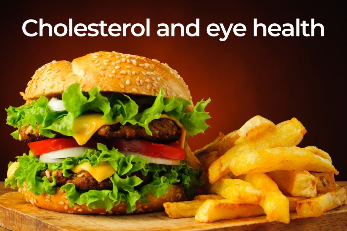 Cholesterol eye health